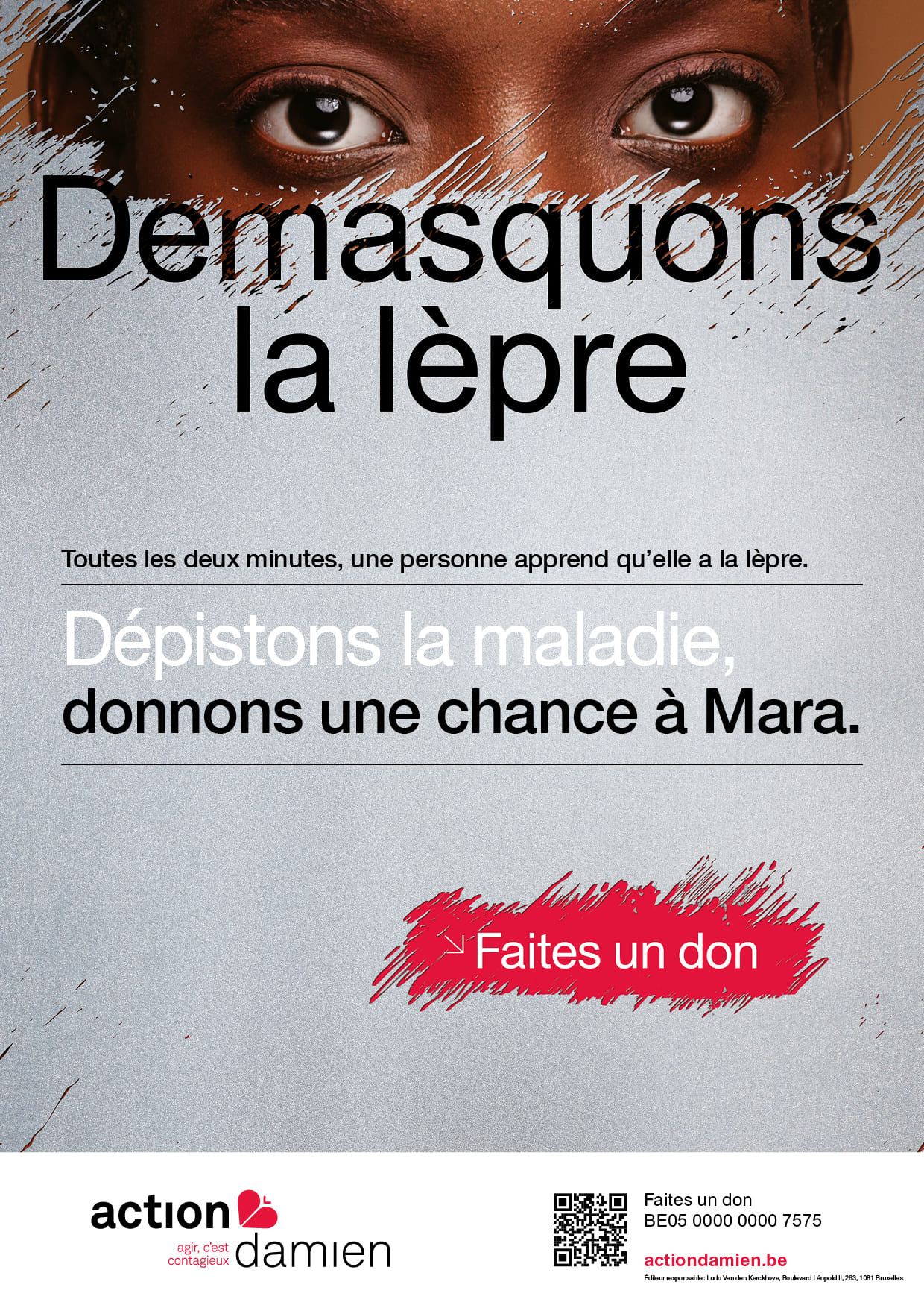 Action Damien - Démasquons la lèpre